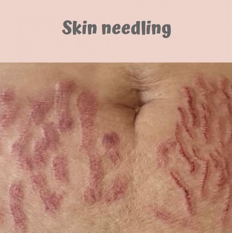 6C73754E F896 4E50 AC5E 5357B2512F97 768x774